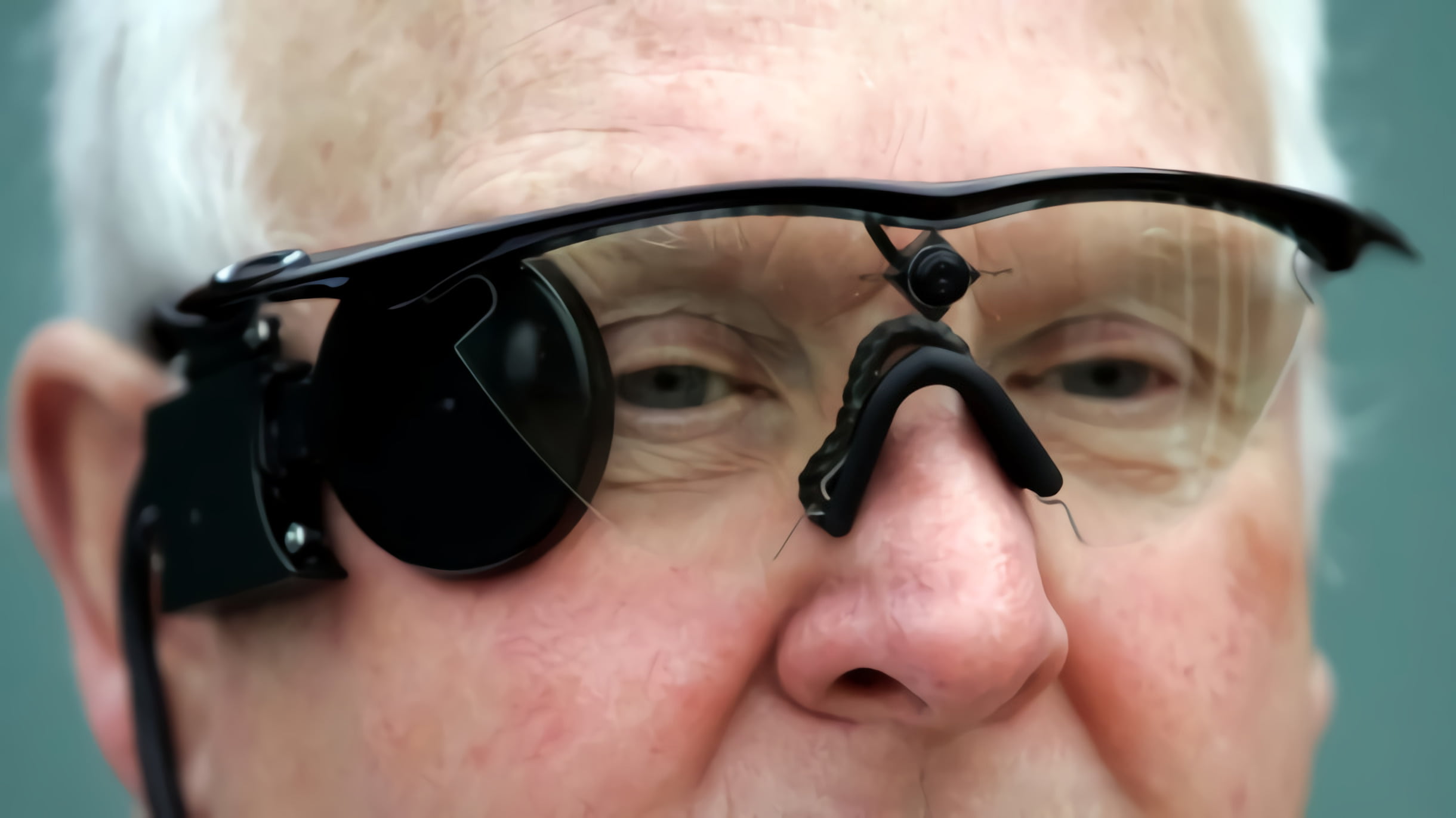 These people have bionic eyes;  now they leave them lying without support